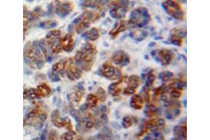 Used in DAB staining on fromalin fixed paraffin-embedded pancreas tissue (GP2 antibody  (AA 300-505))