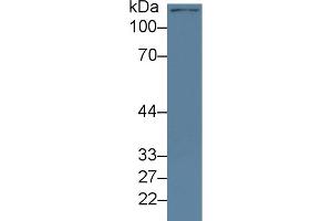Western Blot; Sample: Mouse Cerebrum lysate; Primary Ab: 2µg/ml Rabbit Anti-Human KDM4A Antibody Second Ab: 0. (KDM4A antibody  (AA 141-310))