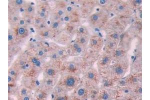 Detection of IL10Ra in Human Liver Tissue using Polyclonal Antibody to Interleukin 10 Receptor Alpha (IL10Ra) (IL-10RA antibody  (AA 132-235))