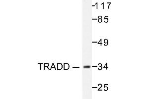 Image no. 1 for anti-TNFRSF1A-Associated Via Death Domain (TRADD) antibody (ABIN271966) (TRADD antibody)