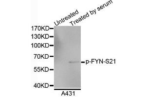 Western blot analysis of extracts of A4731 cells, using Phospho-FYN-S21 antibody. (FYN antibody  (pSer21))