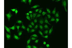 Immunofluorescence analysis of A549 cell using APEX1 antibody. (APEX1 antibody)