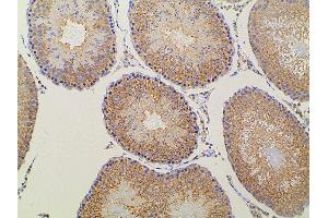 Immunohistochemistry (IHC) image for anti-Ephrin B2 (EFNB2) (C-Term) antibody (ABIN6261455)