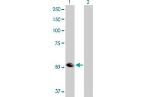Western Blot analysis of TRIP6 expression in transfected 293T cell line by TRIP6 MaxPab polyclonal antibody. (TRIP6 antibody  (AA 1-476))