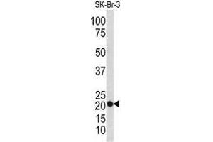 Western blot analysis of TAGLN antibody (N-term) in SK-Br-3 cell line lysates (35ug/lane).