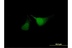 Immunofluorescence of monoclonal antibody to ANKRD37 on HeLa cell. (ANKRD37 antibody  (AA 1-158))