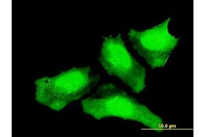 Immunofluorescence of monoclonal antibody to CTNNB1 on HeLa cell. (CTNNB1 antibody  (AA 682-781))