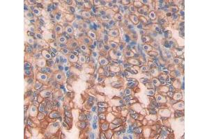 Used in DAB staining on fromalin fixed paraffin- embedded stomach tissue (OSTM1 antibody  (AA 124-277))