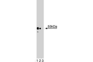Western blot analysis of XRCC4 on a HeLa cell lysate (Human cervical epitheloid carcinoma, ATCC CCL-2. (XRCC4 antibody  (AA 53-168))