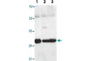 Western blot analysis of SEPT4 expression in human lung (lane 1), spleen (lane 2), and kidney (lane 3) tissue lysates with SEPT4 polyclonal antibody  at 2 ug /mL . (Septin 4 antibody  (N-Term))
