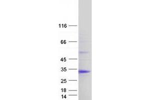 Validation with Western Blot (CHAC1 Protein (Transcript Variant 2) (Myc-DYKDDDDK Tag))