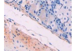 Detection of MYLK in Mouse Stomach Tissue using Polyclonal Antibody to Myosin Light Chain Kinase (MYLK) (MYLK antibody  (AA 1684-1884))