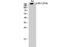 Western Blotting (WB) image for anti-Insulin Receptor Substrate 1 (IRS1) (pSer794) antibody (ABIN3182049) (IRS1 antibody  (pSer794))