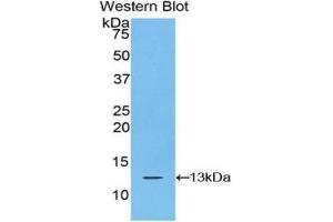 Western Blotting (WB) image for anti-S100 Calcium Binding Protein A10 (S100A10) (AA 1-97) antibody (ABIN1078493) (S100A10 antibody  (AA 1-97))