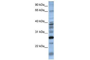 DOLPP1 antibody used at 1 ug/ml to detect target protein.
