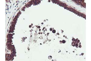 Immunohistochemical staining of paraffin-embedded Human breast tissue using anti-EPN2 mouse monoclonal antibody. (Epsin 2 antibody)