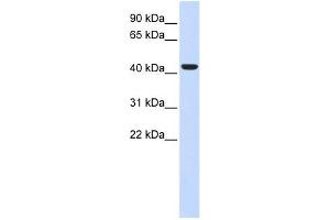 BACE1 antibody used at 1 ug/ml to detect target protein. (BACE1 antibody  (N-Term))