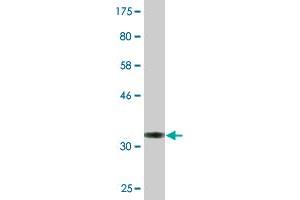 Western Blot detection against Immunogen (34. (ARPC3 antibody  (AA 1-78))