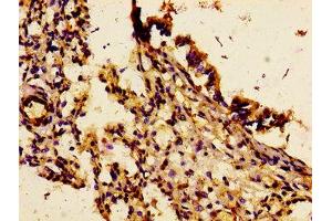 Immunohistochemistry of paraffin-embedded human lung tissue using ABIN7156829 at dilution of 1:100