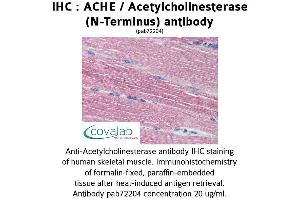 Image no. 1 for anti-Acetylcholinesterase (AChE) antibody (ABIN1731446)
