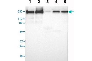 Western Blot analysis of Lane 1: RT-4, Lane 2: U-251MG sp, Lane 3: human plasma (IgG/HSA depleted), Lane 4: human liver and Lane 5: human tonsil lysates with FLNB polyclonal antibody . (FLNB antibody)