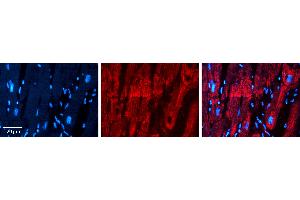 Rabbit Anti-PHB2 Antibody   Formalin Fixed Paraffin Embedded Tissue: Human heart Tissue Observed Staining: Cytoplasmic Primary Antibody Concentration: 1:100 Other Working Concentrations: N/A Secondary Antibody: Donkey anti-Rabbit-Cy3 Secondary Antibody Concentration: 1:200 Magnification: 20X Exposure Time: 0.
