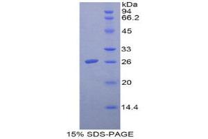 SDS-PAGE (SDS) image for Folate Receptor 1 (Adult) (FOLR1) (AA 26-229) protein (His tag) (ABIN2121091)