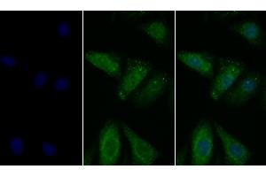 Detection of PDL1 in Human Hela cell using Polyclonal Antibody to Programmed Cell Death Protein 1 Ligand 1 (PDL1) (PD-L1 antibody  (AA 24-234))