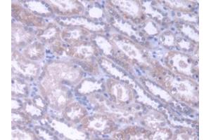 DAB staining on IHC-P; Samples: Human Kidney Tissue (Acylglycerol Kinase antibody  (AA 15-300))