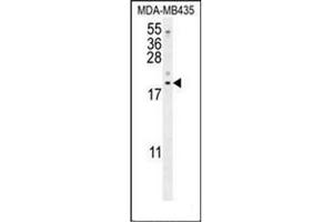 Western blot analysis of LYRM4 Antibody (Center) in MDA-MB435 cell line lysates (35ug/lane). (LYRM4 antibody  (Middle Region))