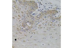 Immunohistochemistry of paraffin-embedded human esophagus using IRF1 antibody. (IRF1 antibody)