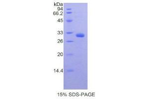 SDS-PAGE (SDS) image for Myosin IA (MYO1A) (AA 783-1043) protein (His tag) (ABIN1878126) (Myosin IA Protein (MYO1A) (AA 783-1043) (His tag))