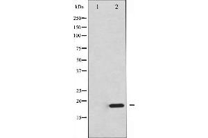 Western blot analysis of 4E-BP1 expression in EGF treated MDA-MB-435 whole cell lysates,The lane on the left is treated with the antigen-specific peptide. (eIF4EBP1 antibody  (Internal Region))