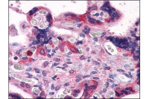 Immunohistochemistry Image: Human Placenta: Formalin-Fixed, Paraffin-Embedded (FFPE) (BAG3 antibody  (C-Term))