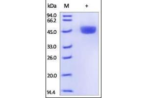 Mouse RENIN, His Tag on SDS-PAGE under reducing (R) condition. (Renin Protein (REN) (AA 22-402) (His tag))