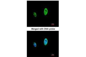 ICC/IF Image Immunofluorescence analysis of paraformaldehyde-fixed HeLa, using TIMELESS, antibody at 1:500 dilution. (TIMELESS antibody  (N-Term))