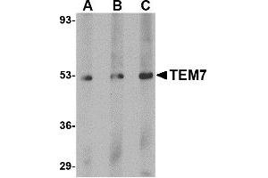 Image no. 1 for anti-Plexin Domain Containing 1 (PLXDC1) (C-Term) antibody (ABIN203738) (PLXDC1 antibody  (C-Term))