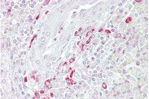 Immunohistochemistry with Spleen tissue at an antibody concentration of 5µg/ml using anti-FRZB antibody (ARP54571_P050) (FRZB antibody  (Middle Region))