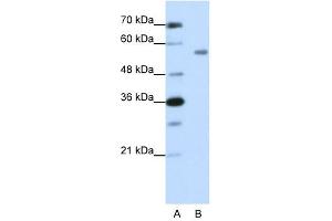 Western Blot showing ZNF497 antibody used at a concentration of 1-2 ug/ml to detect its target protein. (ZNF497 antibody  (N-Term))