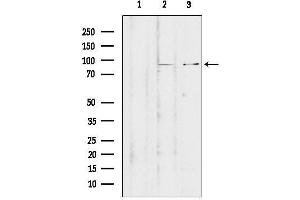 Western blot analysis of lysates from various samples, using ZNF148 Antibody.