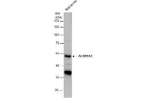 WB Image ALDH1A2 antibody detects ALDH1A2 protein by western blot analysis. (ALDH1A2 antibody)