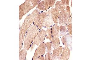 Immunohistochemical analysis of paraffin-embedded H. (CARD6 antibody  (AA 755-787))