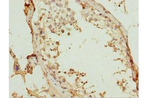 Immunohistochemistry of paraffin-embedded human testis tissue using ABIN7175755 at dilution of 1:100 (WDR47 antibody  (AA 350-600))