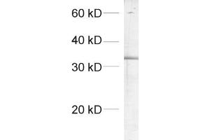 dilution: 1 : 1000, sample: crude synaptosomal fraction of rat brain (P2) (SCAMP1 antibody  (AA 2-15))