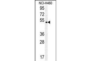 Western blot analysis in NCI-H460 cell line lysates (35ug/lane). (DENND1B antibody  (N-Term))