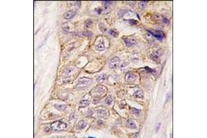 Image no. 2 for anti-Phosphatidylinositol-4-Phosphate 3-Kinase, Catalytic Subunit Type 2 beta (PIK3C2B) (N-Term) antibody (ABIN360437) (PIK3C2B antibody  (N-Term))
