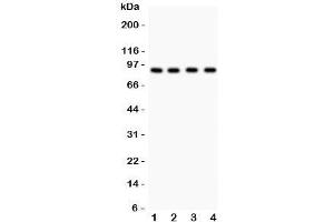 Western blot testing of Furin antibody and Lane 1:  HeLa;  2: MCF-7;  3: COLO320;  4: SW620. (FURIN antibody  (AA 591-794))