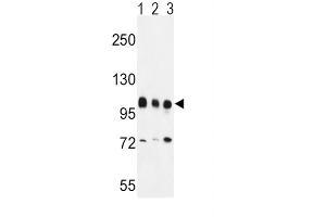 Western Blotting (WB) image for anti-Enhancer of Zeste Homolog 2 (EZH2) antibody (ABIN3001535) (EZH2 antibody)