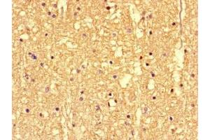 Immunohistochemistry of paraffin-embedded human brain tissue using ABIN7146400 at dilution of 1:100 (SS18L1 antibody  (AA 47-396))