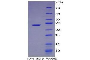 SDS-PAGE (SDS) image for Laminin, alpha 1 (LAMA1) (AA 41-230) protein (His tag) (ABIN1879010) (Laminin alpha 1 Protein (AA 41-230) (His tag))